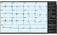 Vistas de electrocardiogramas