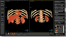 Sincronización de modelos 3D con corregistro