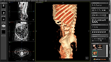 Visualización del volumen en VR 3D, MPR y MIP