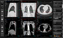 Visualización simultánea de múltiples modelos de volumen