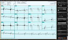 Herramientas ECG