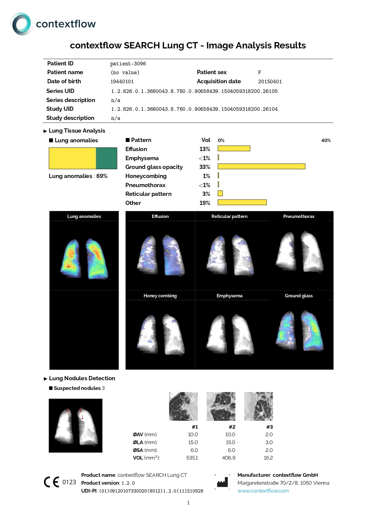 Deteccion de patrones y nodulos pulmonares en CT