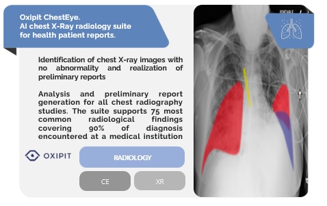 Oxipit Chest X-Ray Image