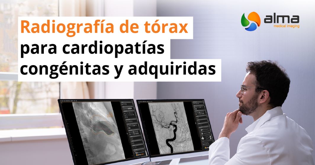 Radiografia de torax cardiologia