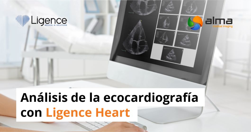analisis ecocardiografia