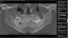 ortopantomografías e imágenes ortorradiales
