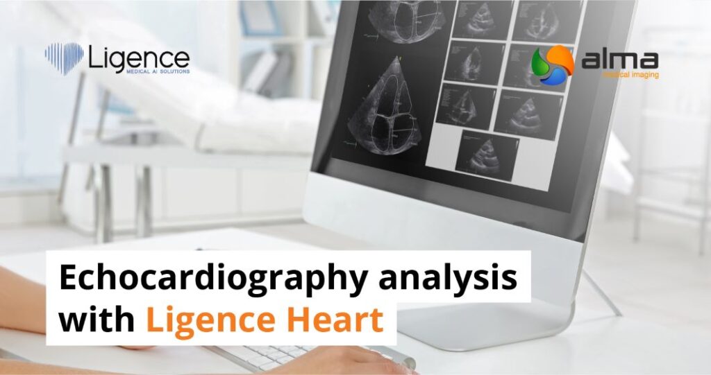 Echocardiography analysis with Ligence Heart