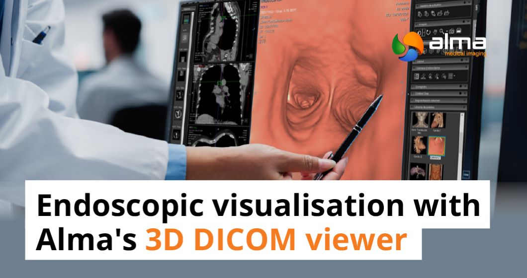 endoscopic visualisation 3d dicom viewer
