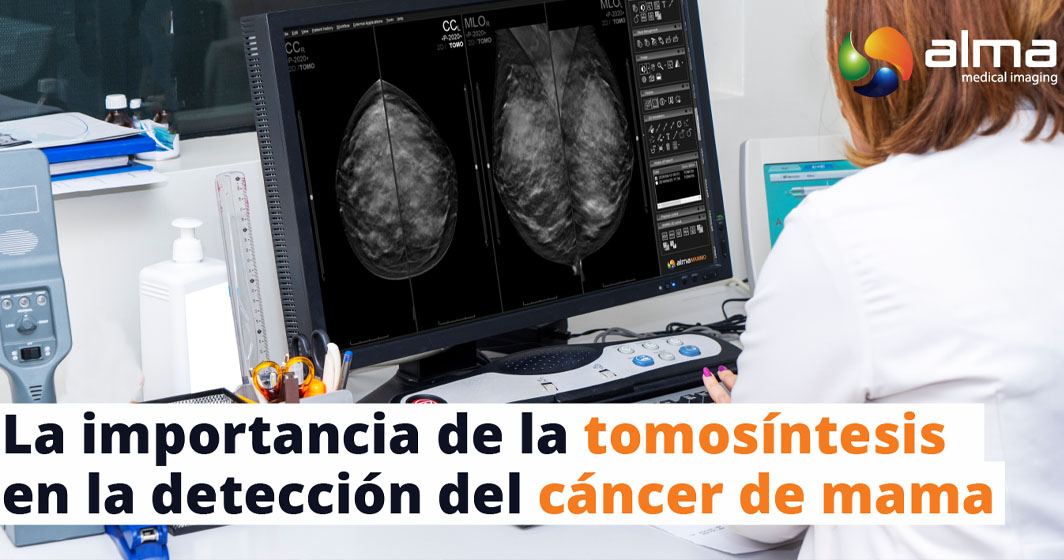 tomosintesis detección cáncer de mama