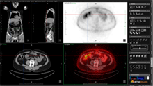 Visualización sincronizada de las series CT y PET por FOV