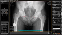 planificacion automatica ortho