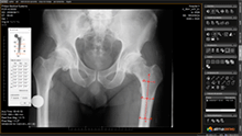 ortho test postquirurgicos