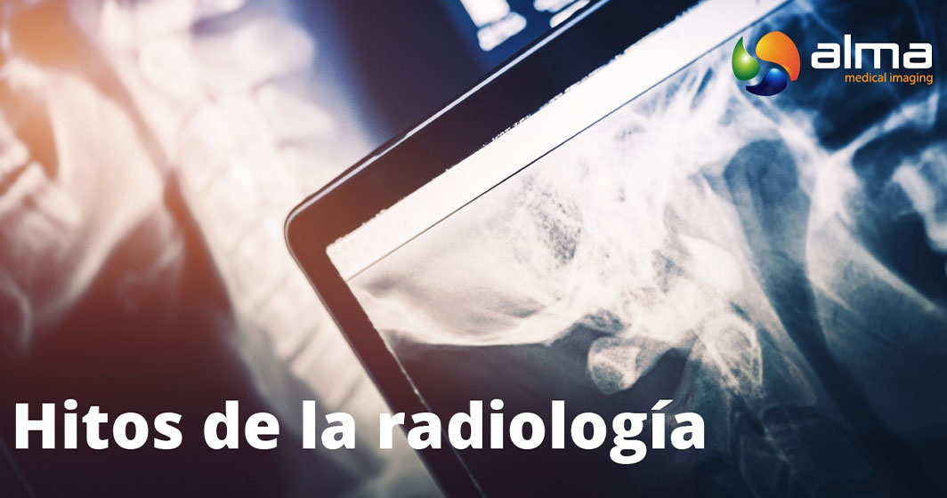 hitos radiología
