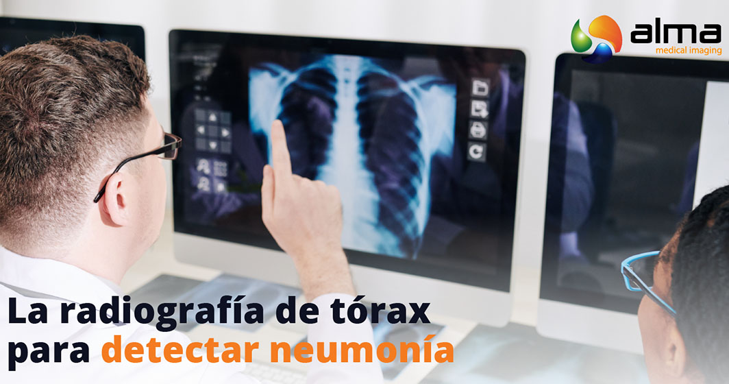 radiografía tórax para detectar neumonia